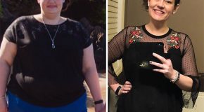 Elle pesait 170 kilos il y ‘a deux ans, aujourd’hui elle a perdu 70 kilos!