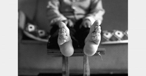 331326-photo-d-une-femme-aux-pieds-bandes-opengraph_1200-2