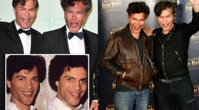 La chirurgie esthétique et les stars! Photos avant-après!